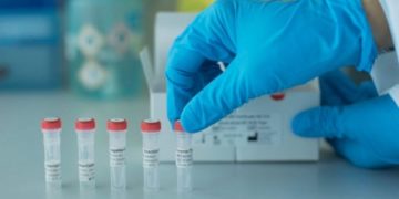 Revisan 9 nuevos casos sospechosos a COVID-19 en Tamaulipas