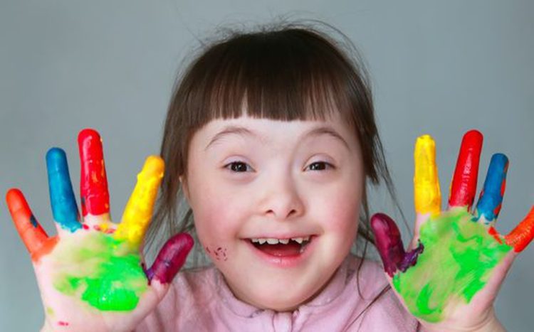 Día Mundial del Síndrome de Down