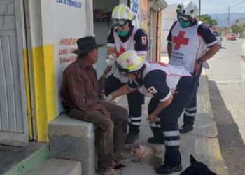 Le amputan dedo a sexagenario para asaltarlo