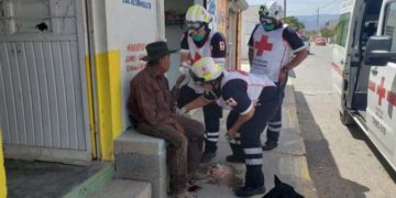 Le amputan dedo a sexagenario para asaltarlo