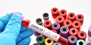 Cofirman 3 nuevo casos positivos a Covid-19, suman 201 casos en Tamaulipas