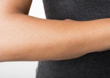 ¿Porqué se nos pone la “piel de gallina”?