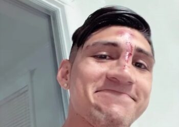 Alan Pulido sufre accidente en su hogar