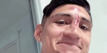 Alan Pulido sufre accidente en su hogar