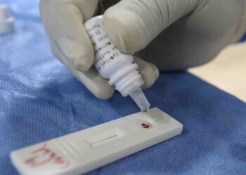 Perú trabaja en prueba para diagnosticar Covid-19 en menos de una hora