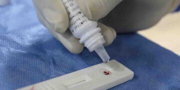 Perú trabaja en prueba para diagnosticar Covid-19 en menos de una hora