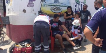 Conductor de auto se pasa alto y lesiona a motociclista