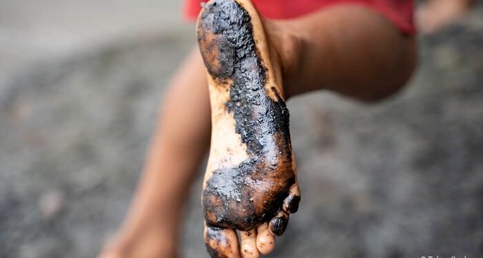 Derrame de crudo en Amazonia deja a miles de indígenas sin agua ni comida