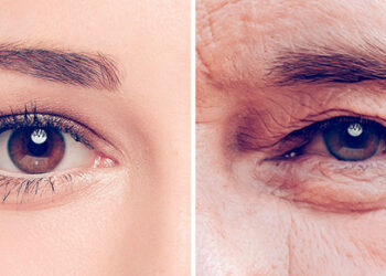 ¿Por qué la piel se arruga con la edad?