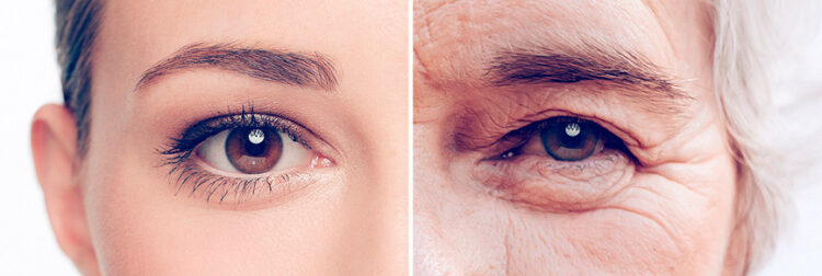 ¿Por qué la piel se arruga con la edad?