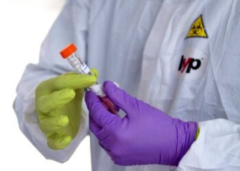 Adquiere Nuevo León 20 mil pruebas PCR para Covid-19