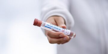 Científicos crean prueba para detectar covid-19 en 40 minutos