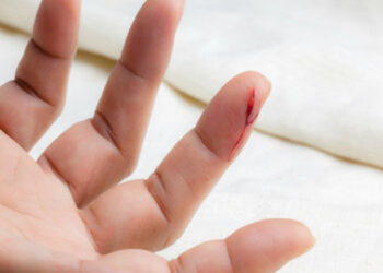 ¿Por qué cuando nos cortamos con papel duele mucho?