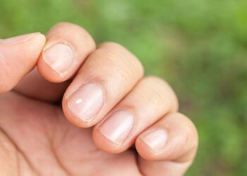¿Por qué salen manchas blancas en las uñas?