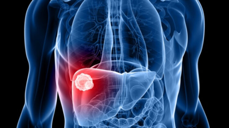 Hoy se celebra el día mundial contra la Hepatitis Vírica