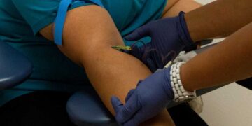 Prueba de sangre puede detectar cáncer con años de anticipación