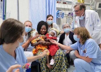 Separan con éxito a gemelas de dos años unidas por la cabeza