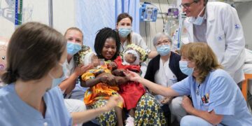 Separan con éxito a gemelas de dos años unidas por la cabeza