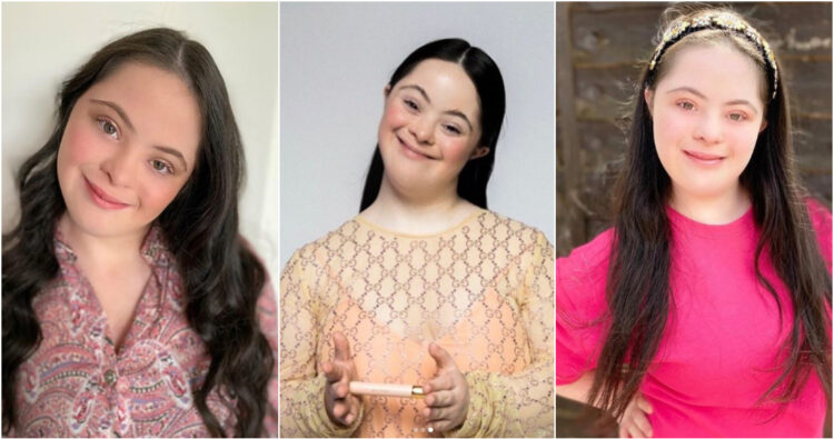 Gucci presenta a Ellie Goldstein su nueva modelo con síndrome de Down