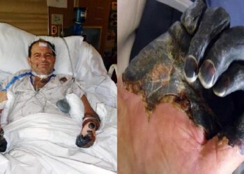 China emiten alerta sanitaria por posible caso de peste bubónica