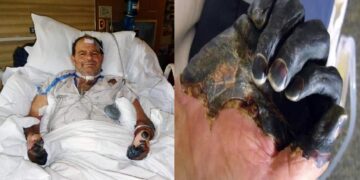 China emiten alerta sanitaria por posible caso de peste bubónica