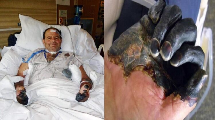 China emiten alerta sanitaria por posible caso de peste bubónica