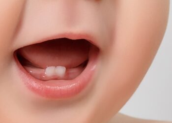 Dientes de leche ¿A qué edad se caen?