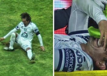 Escalofriante lesión del Burrito Hernández en el duelo ante el Cruz Azul