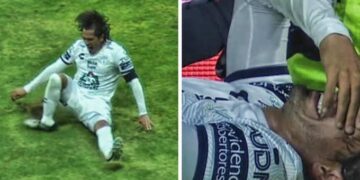 Escalofriante lesión del Burrito Hernández en el duelo ante el Cruz Azul