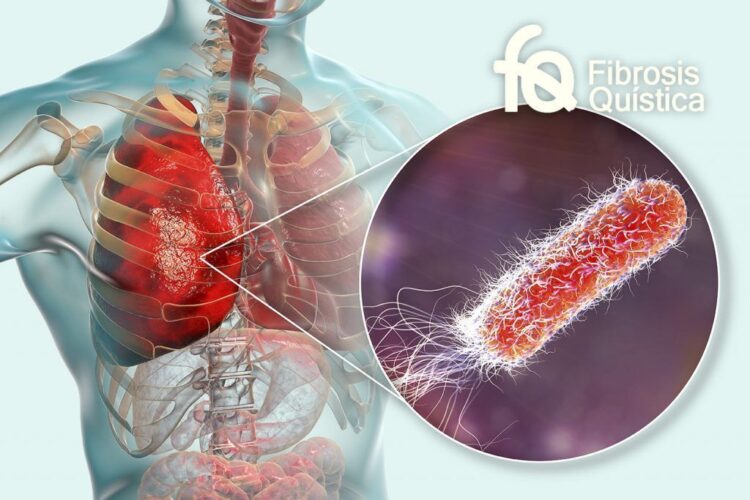 Hoy es el día mundial de la fibrosis quística