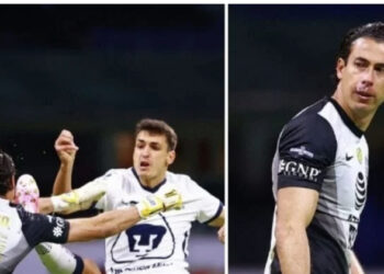 Óscar Jiménez recibe duro golpe en la boca que le provocó severa hinchazón y sangrado