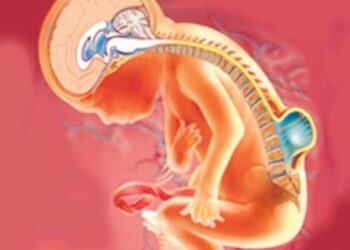 Hoy es el Día Internacional de la espina bífida