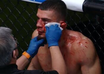 Terrorífica lesión en UFC, ¡se le desprende la oreja a Ramiz Brahimaj y pierde por TKO!