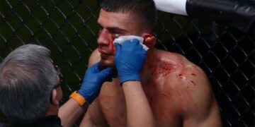 Terrorífica lesión en UFC, ¡se le desprende la oreja a Ramiz Brahimaj y pierde por TKO!
