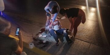 Grave anciano al ser arrollado