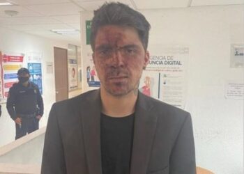 Hijo de Lupita D’Alessio acusa al priista Arturo Montiel de golpearlo