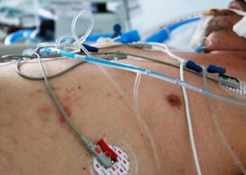 Registra Nuevo León récord de pacientes Covid intubados