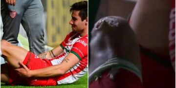 Escalofriante corte de Unai Bilbao y sale entre lágrimas del partido