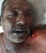 Matan a balazos a jornalero en Tula