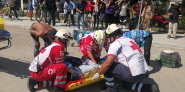 Auto fractura piernas a sexagenario