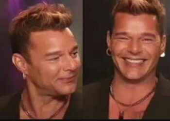 Ricky Martín víctima del botox?