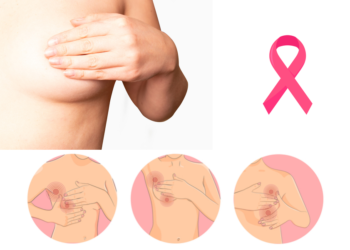 Cáncer de mama segunda causa de muerte a nivel mundial
