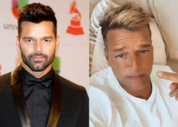 Ricky Martin habla sobre la polémica generada por la apariencia de su rostro