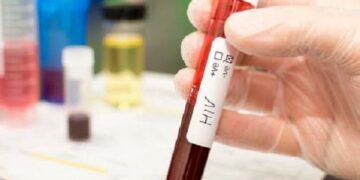 Cada 2 días se registra un caso de VIH/Sida en la zona conurbada