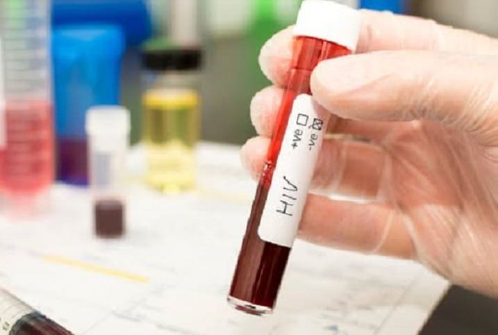 Cada 2 días se registra un caso de VIH/Sida en la zona conurbada