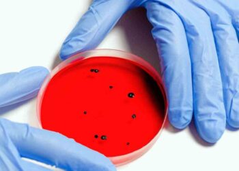 La OMS insta a destruir virus peligrosos en laboratorios de Ucrania