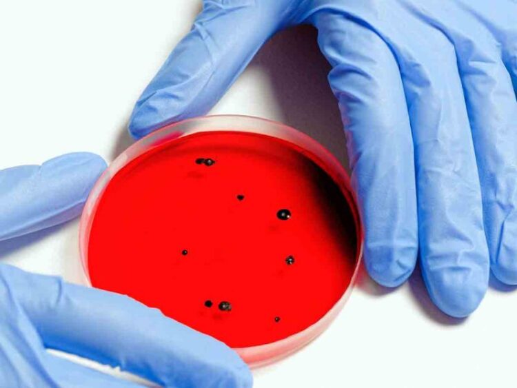 La OMS insta a destruir virus peligrosos en laboratorios de Ucrania