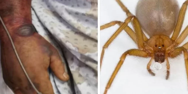 Medidas que te ayudarán a evitar a las arañas violinistas