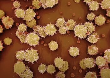 Confirman segundo caso de la viruela del mono