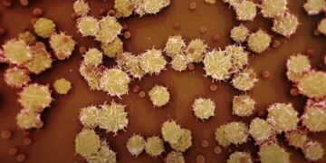 Confirman segundo caso de la viruela del mono